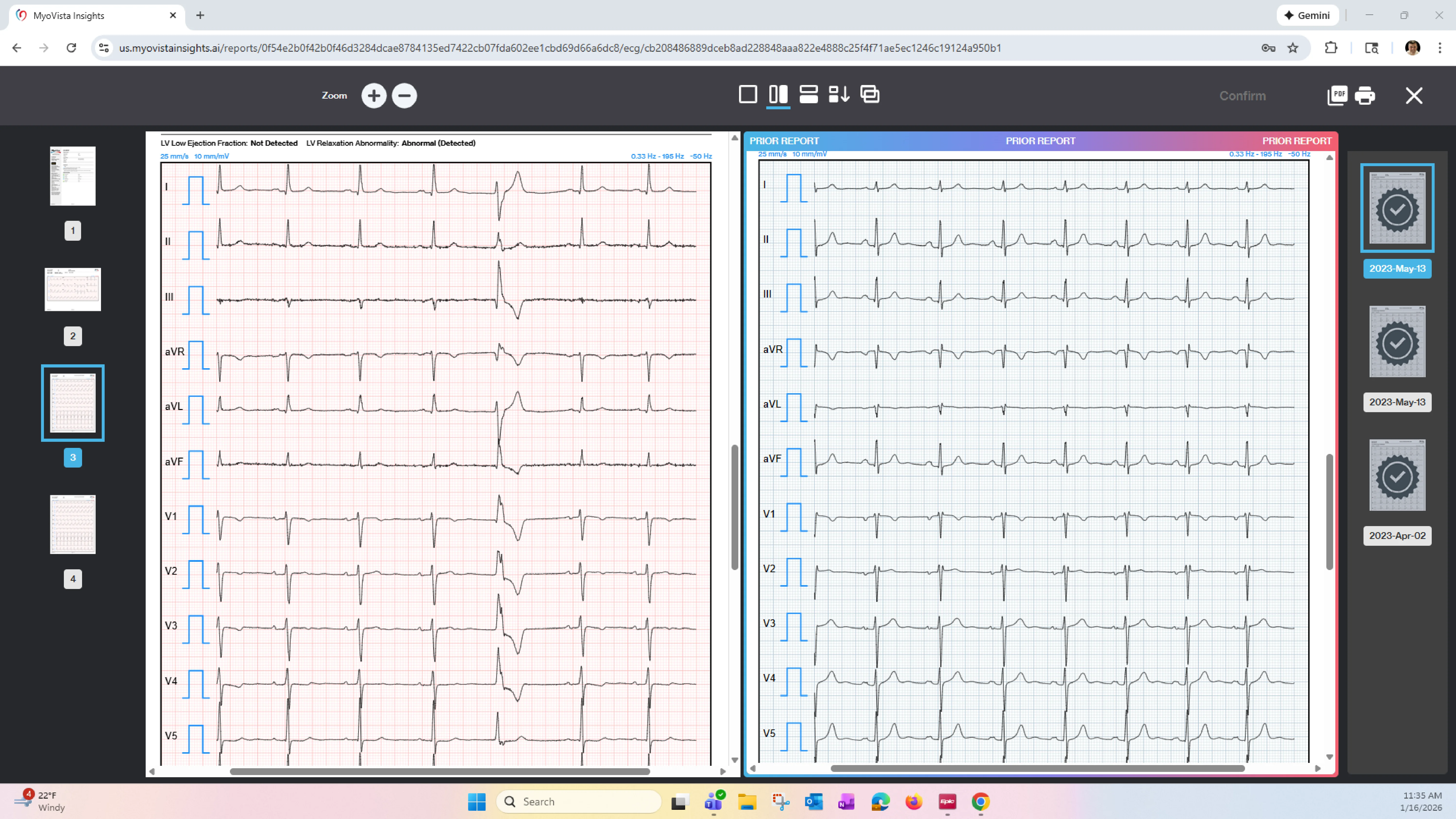 AI-ECG Platform Architecture - End-to-End Workflow